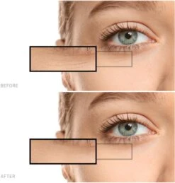 Advanced Hyaluronic Acid Ampoules- 7x2 Ml -Freshs Centsy Shop saffee advanced hyaluronic acid ampoules ampule 7 day intensive treatment with hyaluronic acid 7